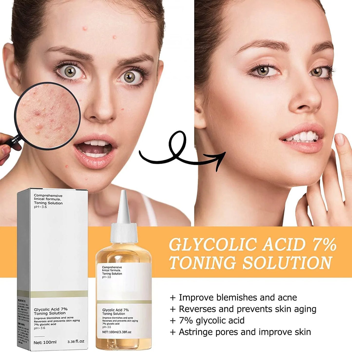 Solution tonifiante à l'acide glycolique 7%, pour éliminer l'acné, hydrate la peau, Lotion rajeunissante, tonique exfoliant au ton acide glycolique doux