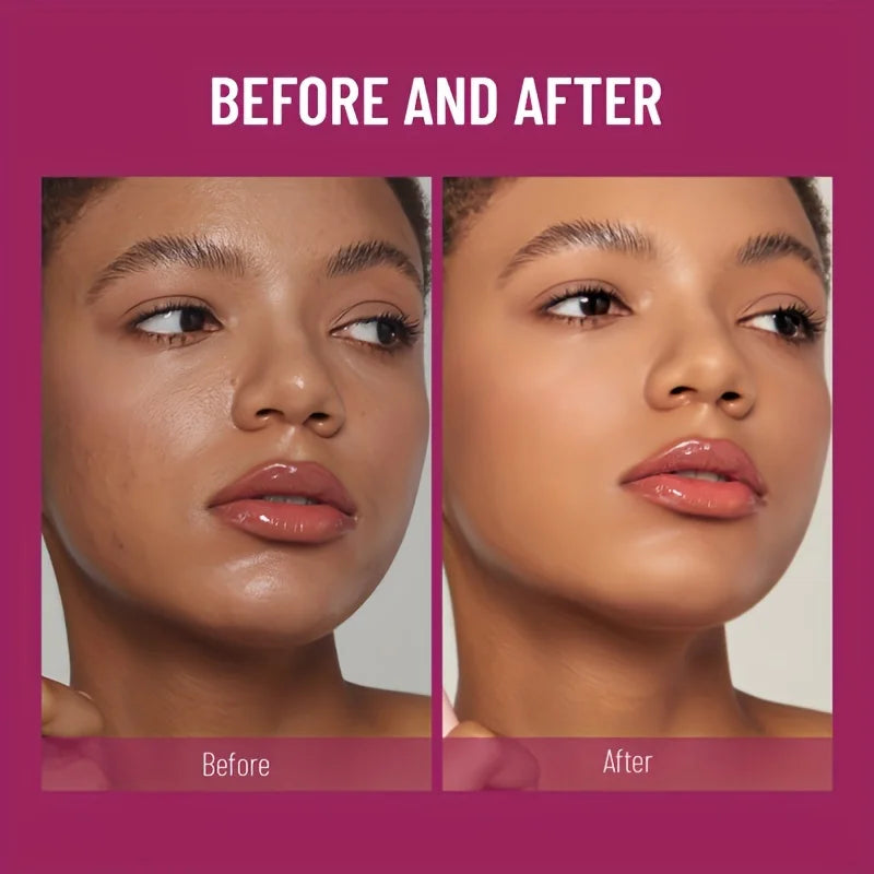Correcteur de tête en éponge pour les taches de rousseur et les taches foncées, fond de teint liquide hydratant longue durée, pigmentation et imperfections de l'acné, nouveau